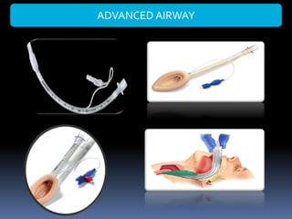 ADVANCED AIRWAY
 