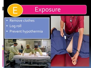Exposure
▪ Remove clothes
▪ Log roll
▪ Prevent hypothermia
E
 