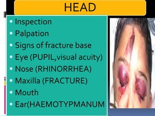 HEAD
▪ Inspection
▪ Palpation
▪ Signs of fracture base
▪ Eye (PUPIL,visual acuity)
▪ Nose (RHINORRHEA)
▪ Maxilla (FRACTURE)
▪ Mouth
▪ Ear(HAEMOTYPMANUM
 