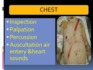 CHEST
▪Inspection
▪Palpation
▪Percussion
▪Auscultation air
entery &heart
sounds
 