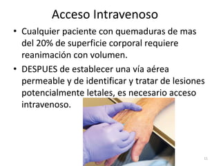Acceso Intravenoso
• Cualquier paciente con quemaduras de mas
del 20% de superficie corporal requiere
reanimación con volumen.
• DESPUES de establecer una vía aérea
permeable y de identificar y tratar de lesiones
potencialmente letales, es necesario acceso
intravenoso.
11
 
