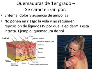 Quemaduras de 1er grado –
Se caracterizan por:
• Eritema, dolor y ausencia de ampollas
• No ponen en riesgo la vida y no requieren
reposición de líquidos IV por que la epidermis esta
intacta. Ejemplo: quemadura de sol
31
 