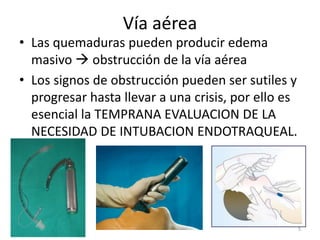 Vía aérea
• Las quemaduras pueden producir edema
masivo  obstrucción de la vía aérea
• Los signos de obstrucción pueden ser sutiles y
progresar hasta llevar a una crisis, por ello es
esencial la TEMPRANA EVALUACION DE LA
NECESIDAD DE INTUBACION ENDOTRAQUEAL.
5
 