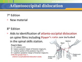 Atlantooccipital dislocation 7 th  Edition New material 8 th  Edition Aids to identification of  atlanto-occipital dislocation  on spine films including  Power’s ratio  are included in the spinal skills station. Power's Ratio:   A = C1 anterior arch,  B = basion (anterior margin of foramen magnum),  C = anterior portion of the posterior ring of C1,  O = opsthion (posterior margin of foramen magnum).  If BC/AO greater than 1,  anterior occipitoatlantal dislocation exists.  