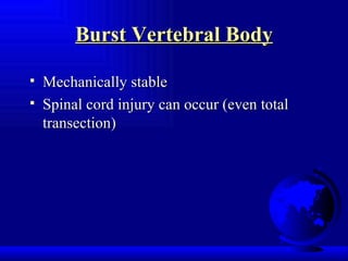 Burst Vertebral Body Mechanically stable Spinal cord injury can occur (even total transection) 