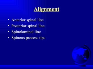 Alignment Anterior spinal line Posterior spinal line Spinolaminal line Spinous process tips 