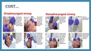 Pediatric Advanced Trauma Life Support (ATLS) | PPTX