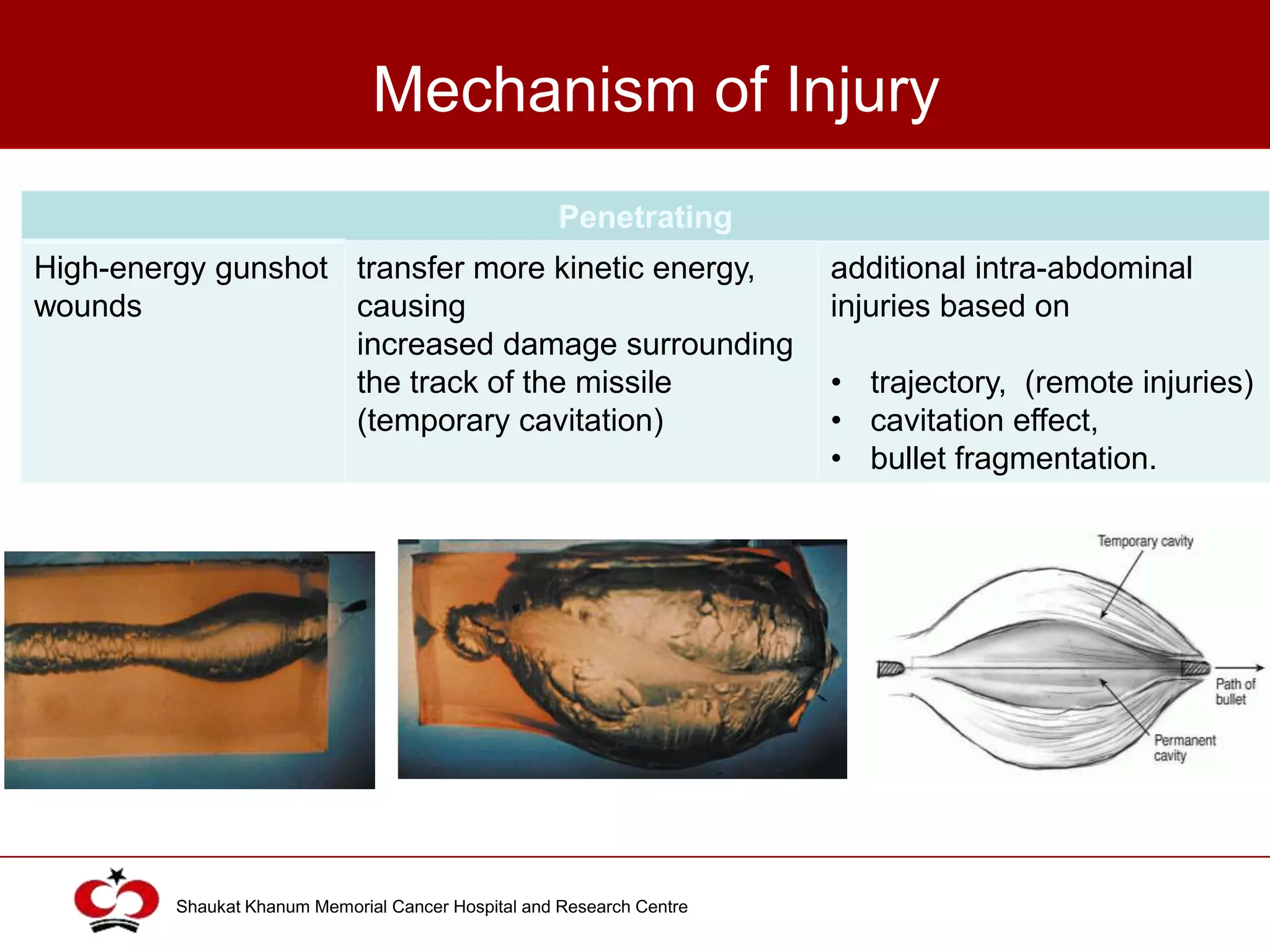 Abdominal and Pelvic Trauma | PPTX
