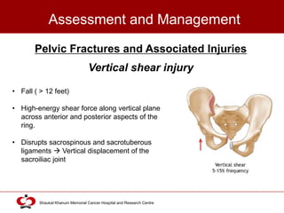Shaukat Rind Abdominal and Pelvic Trauma | PPTX
