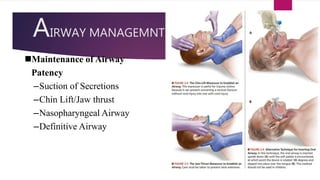 AIRWAY MANAGEMNT
Maintenance of Airway
Patency
–Suction of Secretions
–Chin Lift/Jaw thrust
–Nasopharyngeal Airway
–Definitive Airway
 