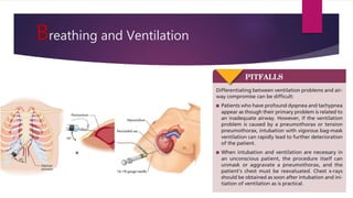 Breathing and Ventilation
 