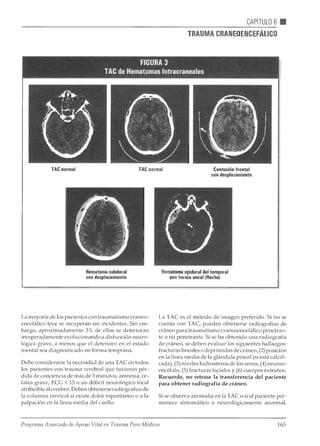 Atls programa avanzadodeapoyovitalentraumaparamédicos