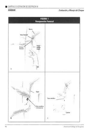 Atls programa avanzadodeapoyovitalentraumaparamédicos