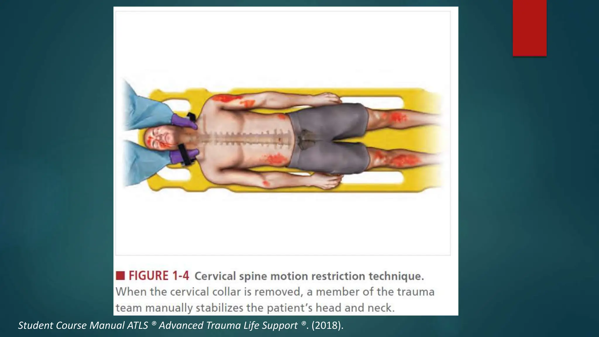 ATLS Protocol.pptx | First Aid | Injuries