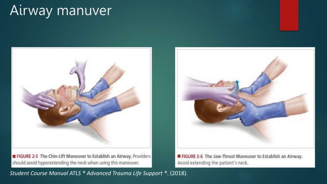 ATLS Protocol.pptx | First Aid | Injuries