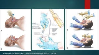 ATLS Protocol.pptx