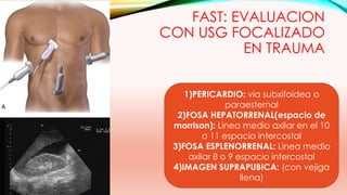 FAST: EVALUACION
CON USG FOCALIZADO
EN TRAUMA
1)PERICARDIO: via subxifoidea o
paraesternal
2)FOSA HEPATORRENAL(espacio de
morrison): Linea medio axilar en el 10
o 11 espacio intercostal
3)FOSA ESPLENORRENAL: Linea medio
axilar 8 o 9 espacio intercostal
4)IMAGEN SUPRAPUBICA: (con vejiga
llena)
 