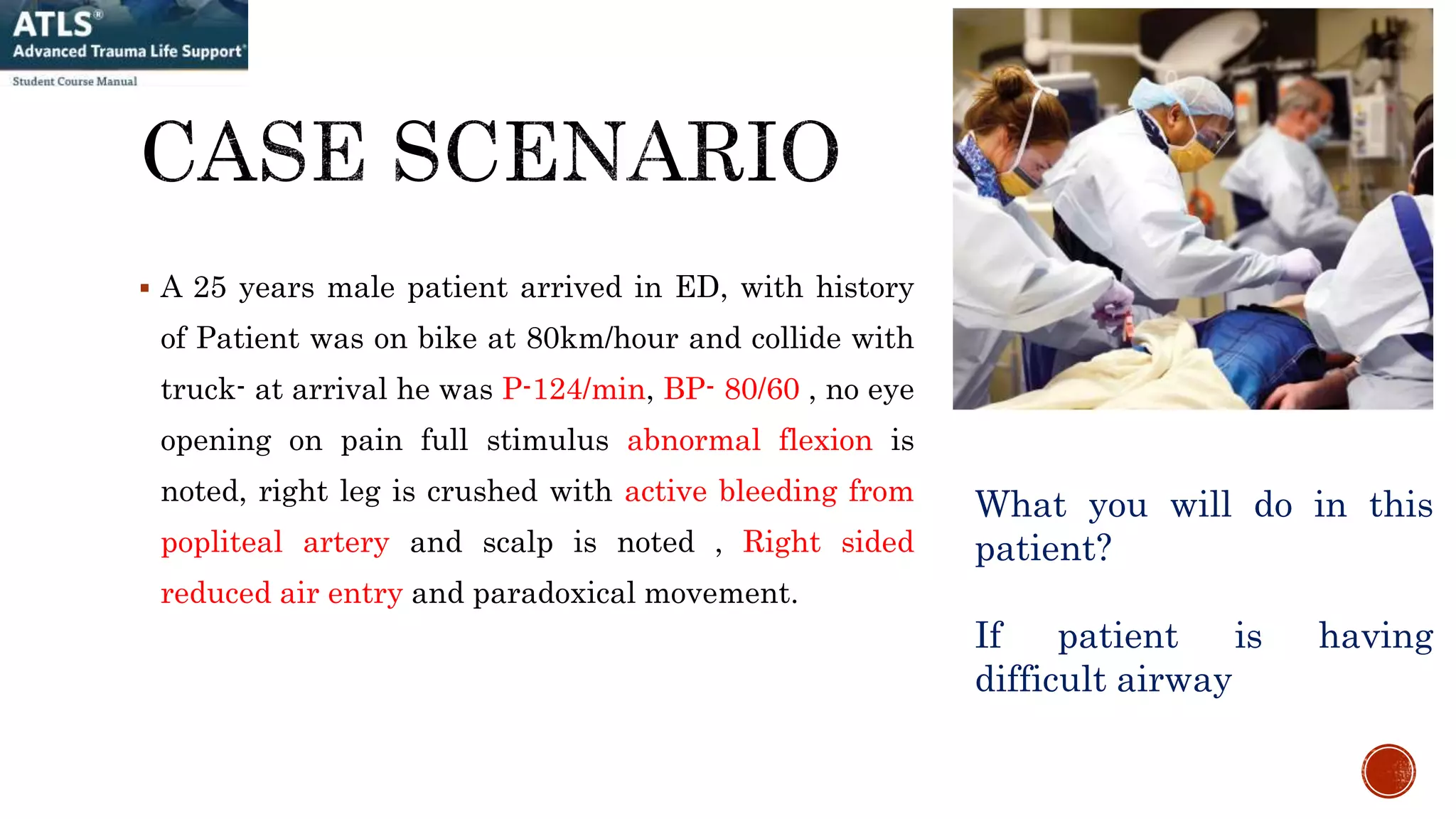  A 25 years male patient arrived in ED, with history
of Patient was on bike at 80km/hour and collide with
truck- at arrival he was P-124/min, BP- 80/60 , no eye
opening on pain full stimulus abnormal flexion is
noted, right leg is crushed with active bleeding from
popliteal artery and scalp is noted , Right sided
reduced air entry and paradoxical movement.
What you will do in this
patient?
If patient is having
difficult airway
 