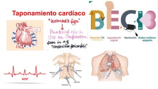Taponamiento cardíaco
AESP
 
