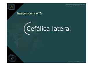Articulación temporo mandibular




Imagen de la ATM




     Cefálica lateral




                       Derechos Reservados © 2008 por A. Padilla
 