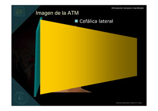 Articulación temporo mandibular

Imagen de la ATM
                   Cefálica lateral




                                      Derechos Reservados © 2008 por A. Padilla
 
