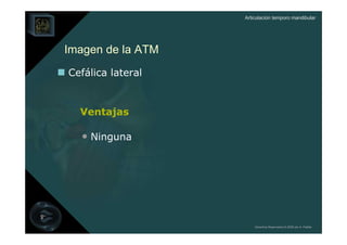 Articulación temporo mandibular




Imagen de la ATM
Cefálica lateral


  Ventajas

  • Ninguna




                       Derechos Reservados © 2008 por A. Padilla
 