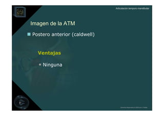 Articulación temporo mandibular




Imagen de la ATM
Postero anterior (caldwell)


  Ventajas

  • Ninguna




                                  Derechos Reservados © 2008 por A. Padilla
 