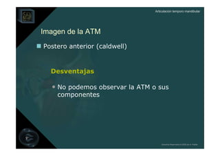 Articulación temporo mandibular




Imagen de la ATM
Postero anterior (caldwell)


  Desventajas

  • No podemos observar la ATM o sus
    componentes




                                    Derechos Reservados © 2008 por A. Padilla
 