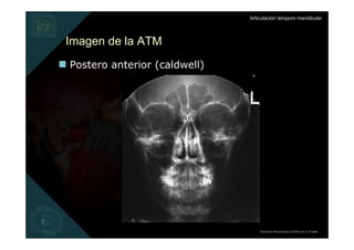 Articulación temporo mandibular



Imagen de la ATM
Postero anterior (caldwell)




                                  Derechos Reservados © 2008 por A. Padilla
 