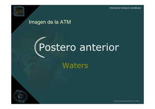 Articulación temporo mandibular




Imagen de la ATM




   Postero anterior
            Waters



                         Derechos Reservados © 2008 por A. Padilla
 