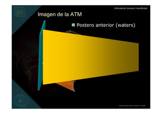 Articulación temporo mandibular


Imagen de la ATM
              Postero anterior (waters)




                                  Derechos Reservados © 2008 por A. Padilla
 