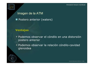 Articulación temporo mandibular




 Imagen de la ATM
  Postero anterior (waters)


Ventajas

• Podemos observar el cóndilo en una distorsión
 postero anterior
• Podemos observar la relación cóndilo-cavidad
 glenoidea



                                        Derechos Reservados © 2008 por A. Padilla
 