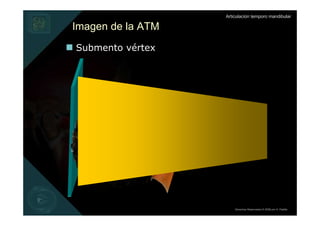 Articulación temporo mandibular

Imagen de la ATM
Submento vértex




                       Derechos Reservados © 2008 por A. Padilla
 