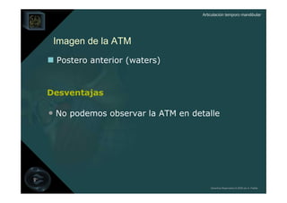 Articulación temporo mandibular




 Imagen de la ATM
 Postero anterior (waters)


Desventajas

• No podemos observar la ATM en detalle




                                       Derechos Reservados © 2008 por A. Padilla
 