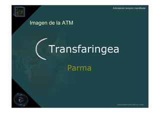 Articulación temporo mandibular




Imagen de la ATM




      Transfaringea
             Parma



                         Derechos Reservados © 2008 por A. Padilla
 