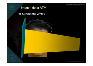 Articulación temporo mandibular

Imagen de la ATM
Submento vértex




                       Derechos Reservados © 2008 por A. Padilla
 