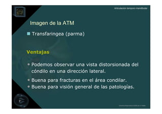 Articulación temporo mandibular




 Imagen de la ATM
  Transfaringea (parma)


Ventajas

• Podemos observar una vista distorsionada del
 cóndilo en una dirección lateral.
• Buena para fracturas en el área condilar.
• Buena para visión general de las patologías.


                                         Derechos Reservados © 2008 por A. Padilla
 