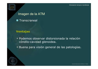 Articulación temporo mandibular




 Imagen de la ATM
  Transcraneal


Ventajas

• Podemos observar distorsionada la relación
 cóndilo-cavidad glenoidea.
• Buena para visión general de las patologías.



                                         Derechos Reservados © 2008 por A. Padilla
 
