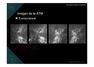 Articulación temporo mandibular




Imagen de la ATM
Transcraneal




                       Derechos Reservados © 2008 por A. Padilla
 