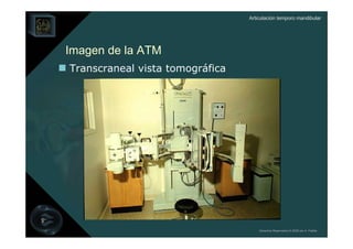 Articulación temporo mandibular




Imagen de la ATM
Transcraneal vista tomográfica




                                     Derechos Reservados © 2008 por A. Padilla
 