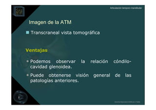 Articulación temporo mandibular




 Imagen de la ATM
 Transcraneal vista tomográfica


Ventajas

• Podemos   observar      la   relación      cóndilo-
 cavidad glenoidea.
• Puede obtenerse visión general de las
 patologías anteriores.



                                              Derechos Reservados © 2008 por A. Padilla
 