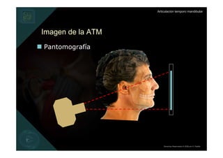 Articulación temporo mandibular




Imagen de la ATM
Pantomografía




                       Derechos Reservados © 2008 por A. Padilla
 