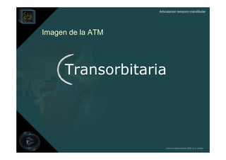 Articulación temporo mandibular




Imagen de la ATM




     Transorbitaria




                       Derechos Reservados © 2008 por A. Padilla
 