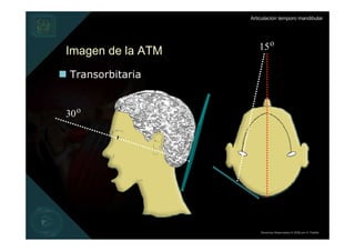 Articulación temporo mandibular




Imagen de la ATM      15 o

 Transorbitaria


30 o




                       Derechos Reservados © 2008 por A. Padilla
 