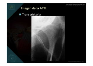 Articulación temporo mandibular


Imagen de la ATM
Transorbitaria




                       Derechos Reservados © 2008 por A. Padilla
 
