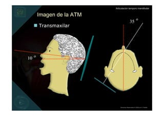 Articulación temporo mandibular


       Imagen de la ATM
                                                     o
                                            35
       Transmaxilar




10 o




                              Derechos Reservados © 2008 por A. Padilla
 