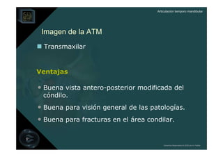 Articulación temporo mandibular




 Imagen de la ATM
  Transmaxilar


Ventajas

• Buena vista antero-posterior modificada del
 cóndilo.
• Buena para visión general de las patologías.
• Buena para fracturas en el área condilar.


                                         Derechos Reservados © 2008 por A. Padilla
 