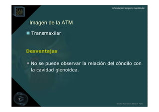 Articulación temporo mandibular




 Imagen de la ATM
  Transmaxilar


Desventajas

• No se puede observar la relación del cóndilo con
 la cavidad glenoidea.




                                         Derechos Reservados © 2008 por A. Padilla
 