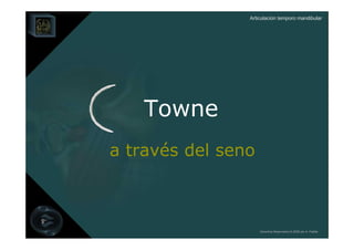 Articulación temporo mandibular




    Towne
a través del seno



                    Derechos Reservados © 2008 por A. Padilla
 