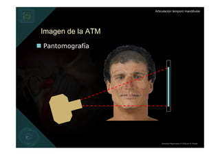 Articulación temporo mandibular




Imagen de la ATM
Pantomografía




                       Derechos Reservados © 2008 por A. Padilla
 